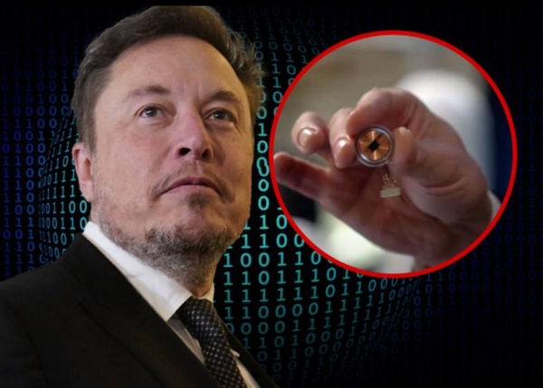 Компания Илона Маска Neuralink вживила первый имплант в мозг человека Компания Илона Маска Neuralink вживила первый имплант в мозг человека